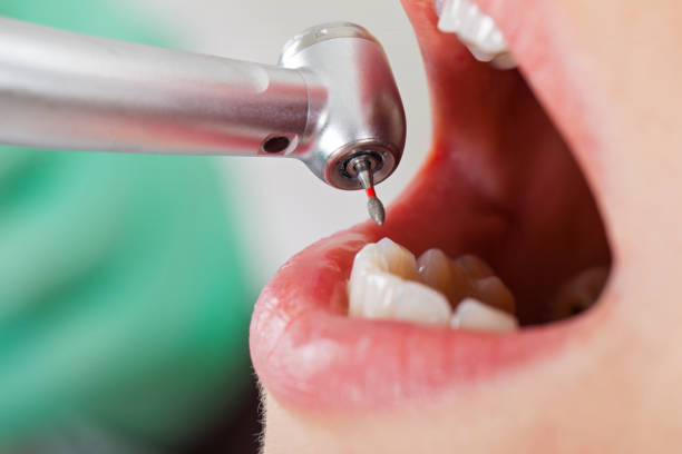 Best Weekend Emergency Dentist in Sterling, KS